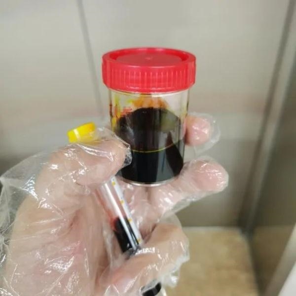 急性肝衰竭！兩兄弟誤吃這種菌 專家提醒